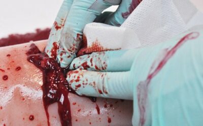 Initiatie “Bleeding Control” in oktober voor “Talent in Motion” via “The R.A.I.D. Team”